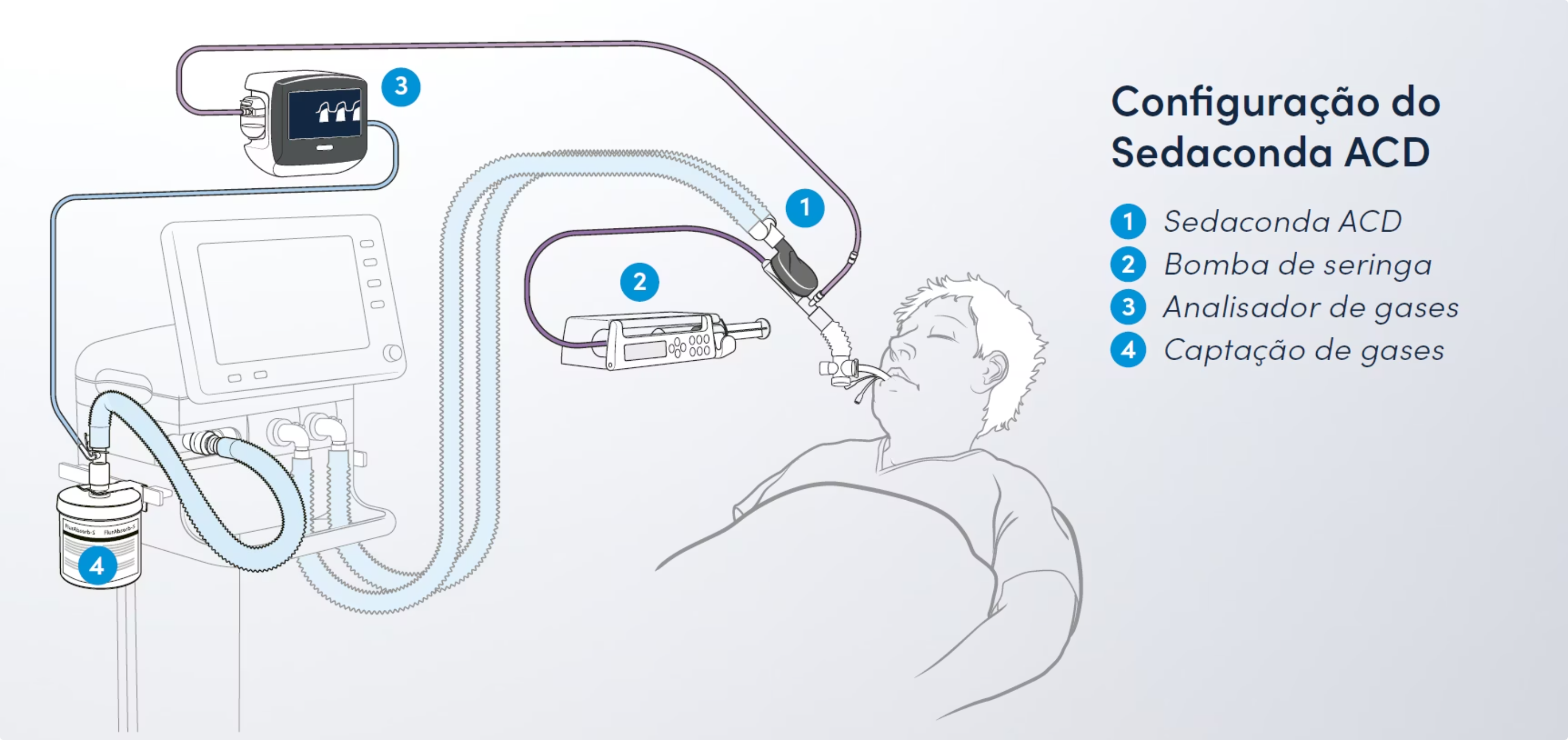 Configuração do Sedaconda ACD: dispositivo, bomba de seringa, analisador de gases e captação de gases conectados ao paciente